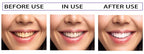 MAGIC SMILE - Dentifrice blanchissant